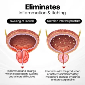 Last Day Discount: 87% OFF 🎇 LOVILDS™ ProstaAir Dual-Function Nasal Inhaler🌟