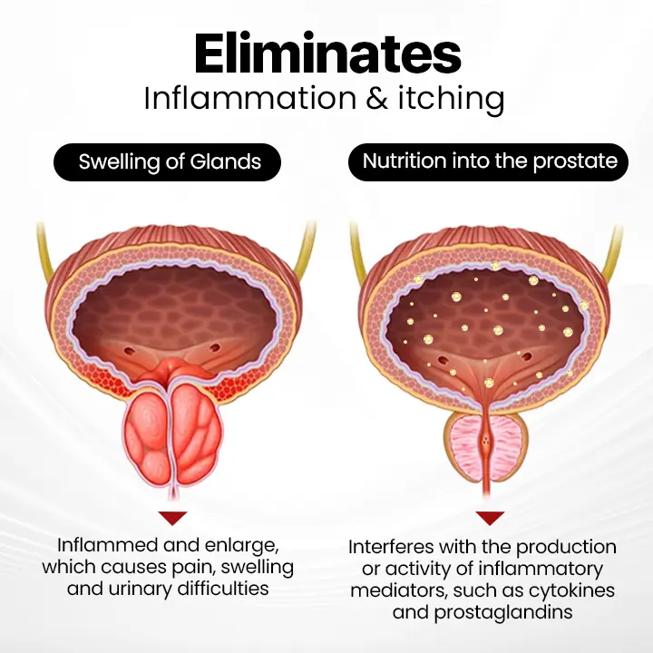 Last Day Discount: 87% OFF 🎇 LOVILDS™ ProstaAir Dual-Function Nasal Inhaler🌟