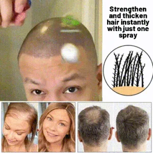 🔥(Last Day SAVE 60% OFF)LOVILDS Natural Hair Regrowth Spray