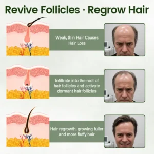 Lovilds® Hair Restoration Spray ( Reawaken Your Roots. Regrow Naturally. ✨ Clinically Proven Hair Regrowth Within 4 Weeks ✨)