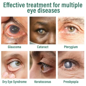 Lovilds® Nano Eye Drops Serum 👩‍⚕️ Royal College of Ophthalmologists Recommended (Suitable for presbyopia, dry eye syndrome, glaucoma, and cataracts)