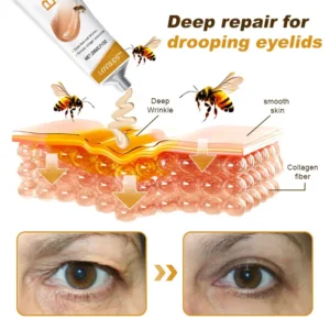 (Made and Shipped from USA) 🧑‍⚕️LOVILDS™ BEE TOXIN  Wrinkle Removal Cream