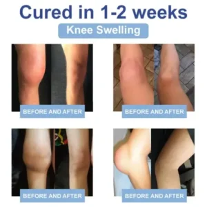 LOVILDS™ Black Rice Pain Healing Bone Cream