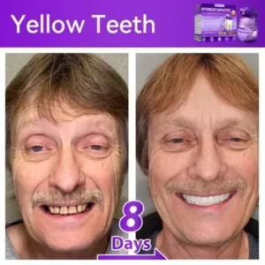 Lovilds® 𝐻𝑦𝑑𝑟𝑜𝑥𝑦𝑎𝑝𝑎𝑡𝑖𝑡𝑒 𝑇𝑜𝑜𝑡ℎ 𝑅𝑒𝑠𝑡𝑜𝑟𝑎𝑡𝑖𝑣𝑒 𝑃𝑜𝑤𝑑𝑒𝑟