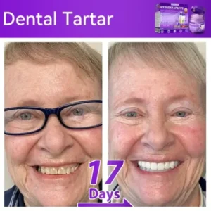 Lovilds® 𝐻𝑦𝑑𝑟𝑜𝑥𝑦𝑎𝑝𝑎𝑡𝑖𝑡𝑒 𝑇𝑜𝑜𝑡ℎ 𝑅𝑒𝑠𝑡𝑜𝑟𝑎𝑡𝑖𝑣𝑒 𝑃𝑜𝑤𝑑𝑒𝑟