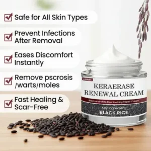 🔥 Flash Sale: LOVILDS® KeraErase Dual-Action Renewal Cream