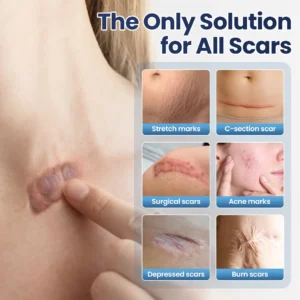 🔥 LOVILDS® Texture Repair Gel