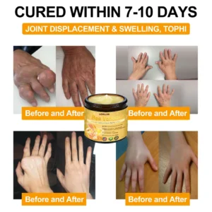 LOVILDS Bee Venom Advanced Joint and Bone Healing Cream