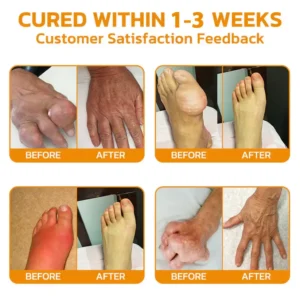 LOVILDS Bee poison Pain ArthritisTherapy Cream (specially forolder adults & AAOSrecommends)