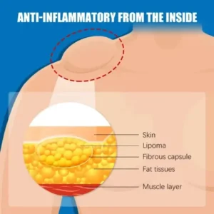 LOVILDS™ LIPOMA CREAM