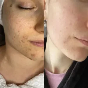 LOVILDS™ Water Light Anti-Aging Facial Cream