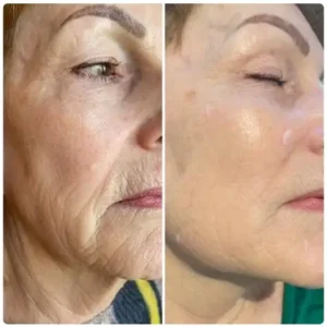 LOVILDS™ Water Light Anti-Aging Facial Cream