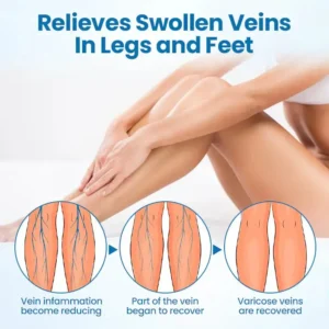 Lovilds® VeinGuard Herbal Spray-✅ Clinically proven to eliminate varicose veins in just 7 days!