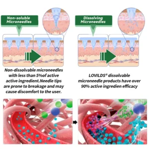 ๐ถ๐๐๐๐๐๐๐ ๐บ๐๐๐๐ |๐ก๏ธLOVILDSยฎ ๐ด๐๐๐๐๐๐ & ๐ฉ๐๐๐๐๐๐๐๐ 10-๐ฐ๐ต-1 ๐จ๐
๐๐๐๐๐๐
๐ต๐๐๐ ๐ด๐๐๐๐๐๐๐๐
๐๐ ๐ท๐๐๐๐ (๐๐ง๐๐ ๐๐๐ข๐ฅ๐ฒ, ๐ฏ๐ข๐ฌ๐ข๐๐ฅ๐ ๐๐ก๐๐ง๐ ๐๐ฌ ๐ข๐ง ๐ ๐๐๐ฒ๐ฌ๏ผโ
๐๐๐๐ฌ๐ข๐ญ๐ฒ, ๐๐ข๐๐๐๐ญ๐๐ฌ, ๐๐ฅ๐๐๐ฉ ๐๐ฉ๐ง๐๐, ๐๐ง๐ ๐๐จ๐ข๐ง๐ญ ๐๐ฌ๐ฌ๐ฎ๐๐ฌ