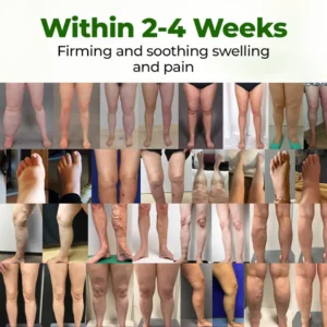 𝑶𝒇𝒇𝒊𝒄𝒊𝒂𝒍 𝑺𝒕𝒐𝒓𝒆 |🛡️LOVILDS® Professional Leg Circulation Cream