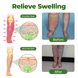 𝑶𝒇𝒇𝒊𝒄𝒊𝒂𝒍 𝑺𝒕𝒐𝒓𝒆 |🛡️LOVILDS® Professional Leg Circulation Cream