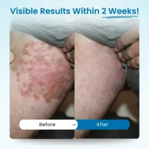 LOVILDS® – Mens GentCare Relief Cream