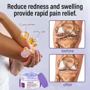 LOVILDS™ Arthritis Relief Gel: Turmeric & Emu Oil for Fast Soothing Relief