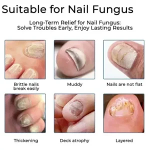 LOVILDS® FUNGAL NAIL PATCHES