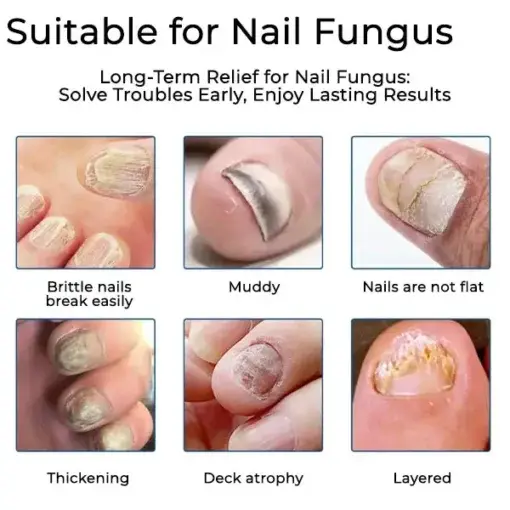 LOVILDS® FUNGAL NAIL PATCHES