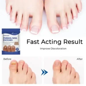 LOVILDS® FUNGAL NAIL PATCHES