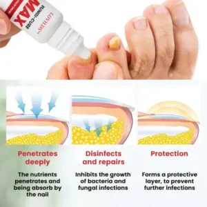 LOVILDS™ Fungi-Cure Max
