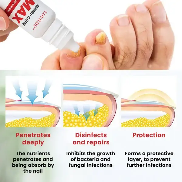 LOVILDS™ Fungi-Cure Max