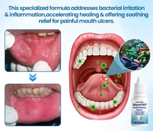 LOVILDS™ NanoHAP Tooth Defense Serum