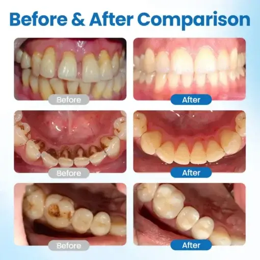 LOVILDS™ NanoHAP Tooth Defense Serum