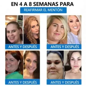 Valentine’s Day Special ⭐ Risarisa® 7-in-1 Patch for Weight & Cravings Control