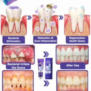 LOVILDS™ Bee Poison Dental Treatment Toothpaste
