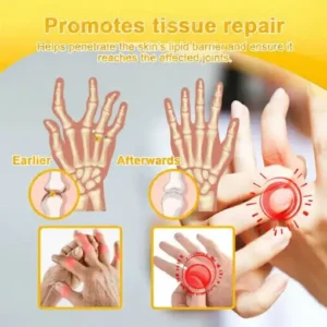 LOVILDS™ Bee Poison Pain-Relief Bone Healing Cream (Specially for older adults)