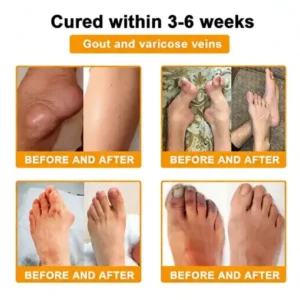 LOVILDS™ Bee Poison Pain-Relief Bone Healing Cream (Specially for older adults)