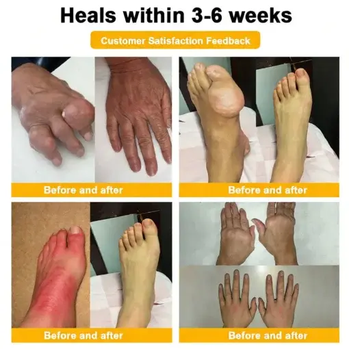 LOVILDS™ Bee Poison Pain-Relief Bone Healing Cream (Specially for older adults)