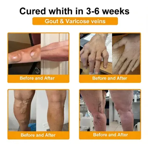 LOVILDS™ Bee Poison Pain-Relief Bone Healing Cream (Specially for older adults)