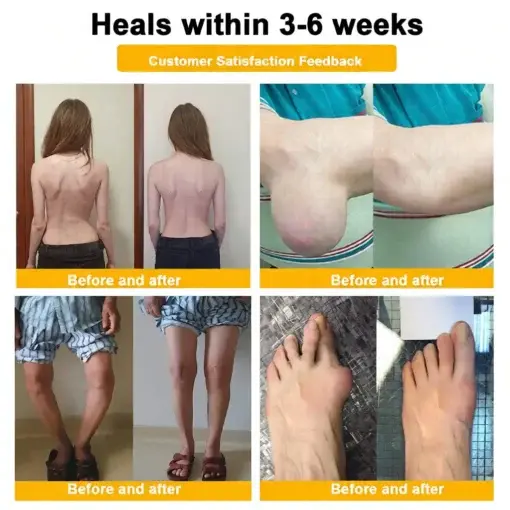 LOVILDS™ Bee Poison Pain-Relief Bone Healing Cream (Specially for older adults)