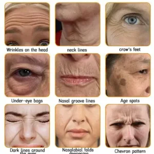 LOVILDS™ 🐝Bee Poison Skin Restoration Cream 🐝