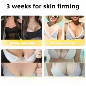 LOVILDS™ 🐝Bee Poison Skin Restoration Cream 🐝