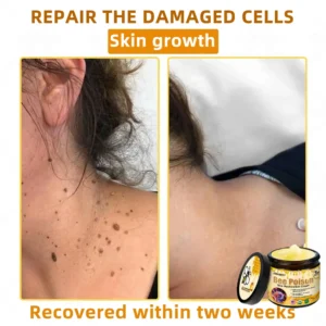 LOVILDS™ 🐝Bee Poison Skin Restoration Cream 🐝