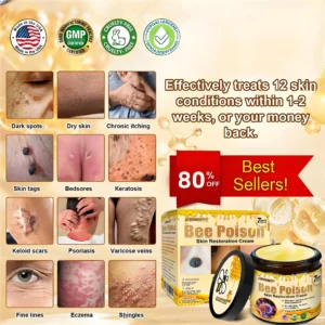 LOVILDS™  Bee Poison Skin Restoration Cream 👨‍⚕️（🔥LAST DAY SALE-80% OFF)🥇👩‍⚕️