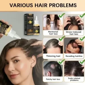 LOVILDS® Highly Effective Biotin & Rosemary Hair Growth Serum