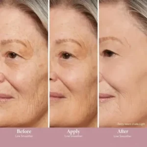 LOVILDS™ Instant Line Filler——Smooth Lines in Seconds