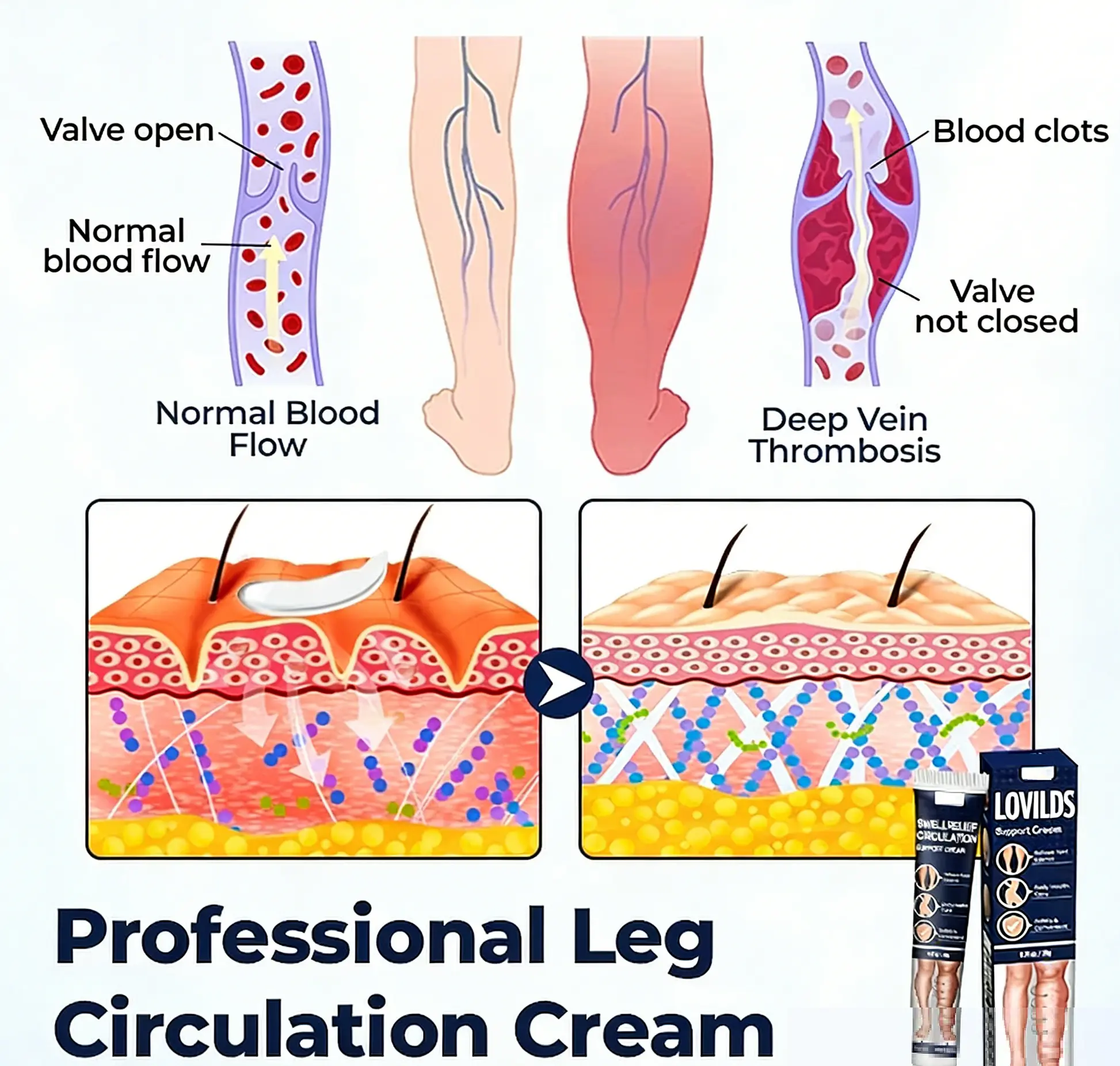 LOVILDS® Swell Relief Circulation Support Cream 🎁 2026 Best Seller