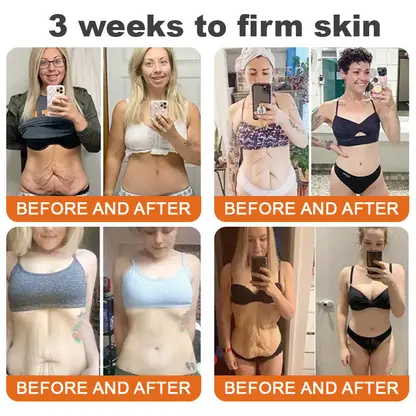 LOVILDS®Tightening Burn Gold Massage Cream(⏳LAST DAY 70% OFF)✨