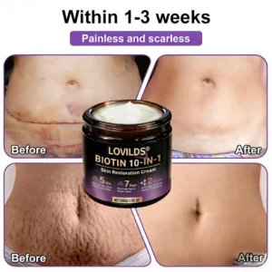 Made and Shipped from UK ✨LOVILDS® Biotin 10-in-1 Skin Restoration Cream🌻🌻