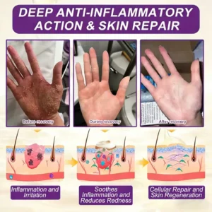 Made and Shipped from USA❤️LOVILDS® Biotin 10-in-1 Skin Restoration Cream 🍀