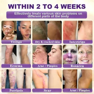 Made and Shipped from USA❤️LOVILDS® Biotin 10-in-1 Skin Restoration Cream 🍀