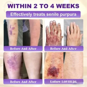 Made and Shipped from USA❤️LOVILDS® Biotin 10-in-1 Skin Restoration Cream 🍀