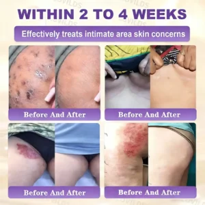 Made and Shipped from USA❤️LOVILDS® Biotin 10-in-1 Skin Restoration Cream 🍀