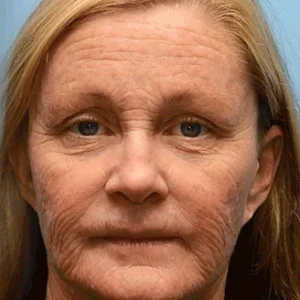 🧠👨⚕️Made and shipped from the USA 💫LOVILDS® moringa & Vita-A Retinol Shot Wrinkle-Lift Tightening cream - Last Day Promotion 50% OFF